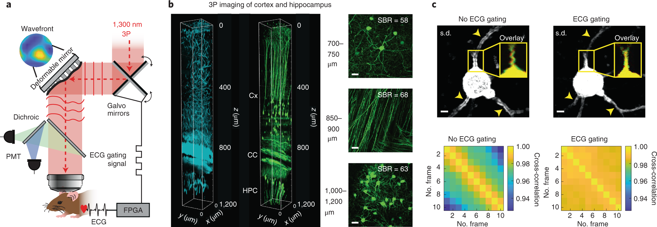 mil Ejemplo Clancy High-resolution structural and functional deep brain imaging using adaptive optics three-photon microscopy | Nature Methods mil Ejemplo Clancy High-resolution structural and functional deep brain imaging using adaptive optics three-photon microscopy | Nature Methods