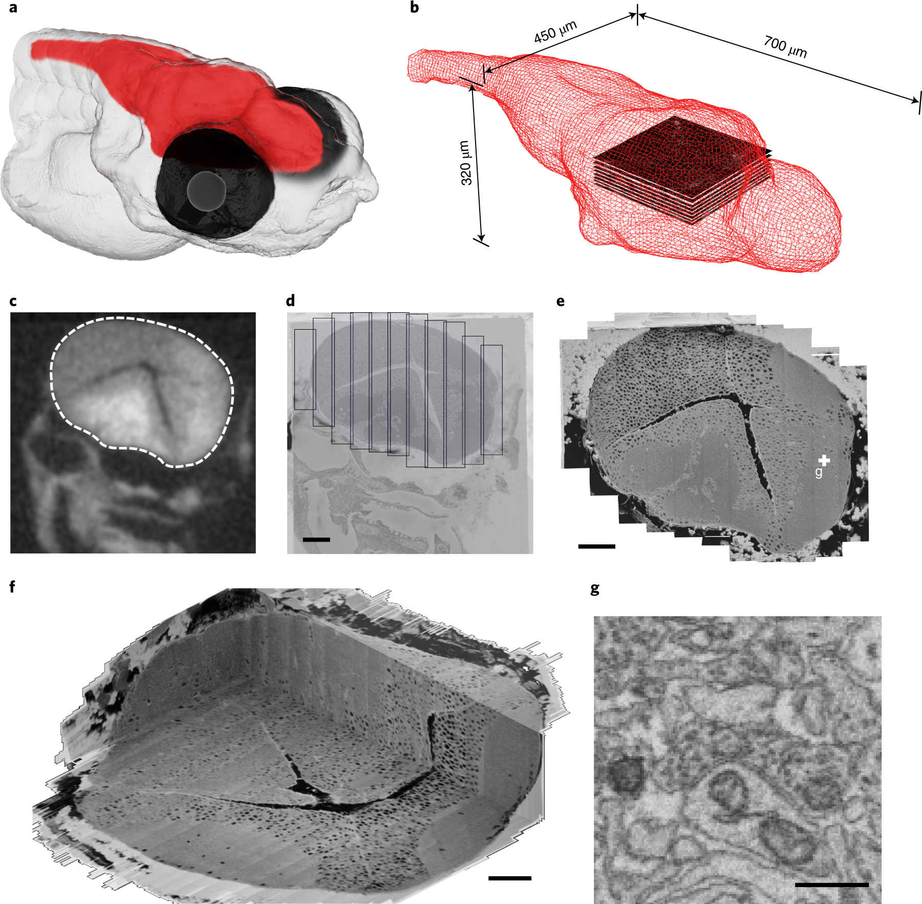 Selective Brain Distribution and Distinctive Synaptic Architecture