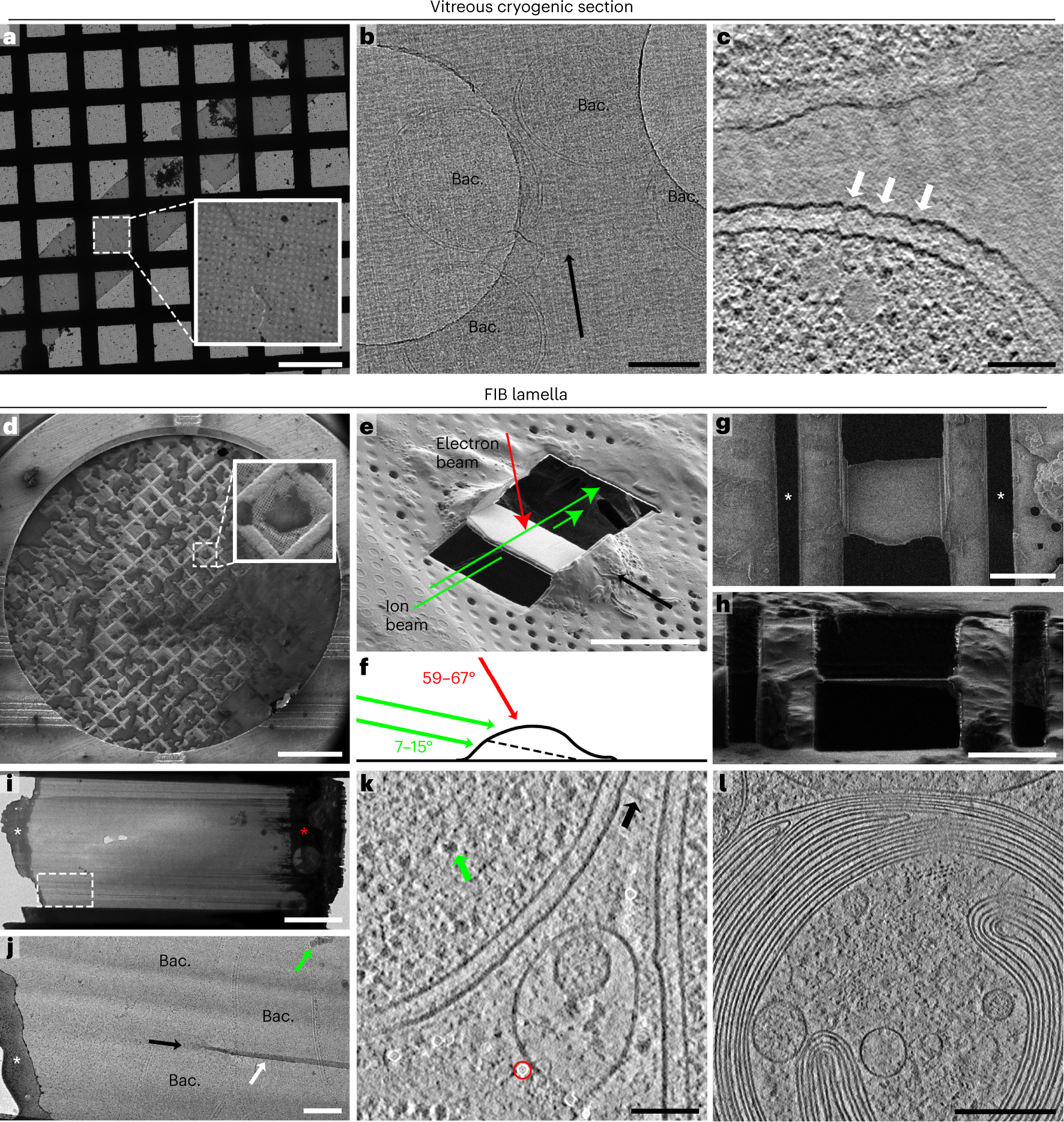 Cryo-electron tomography on focused ion beam lamellae transforms structural  cell biology