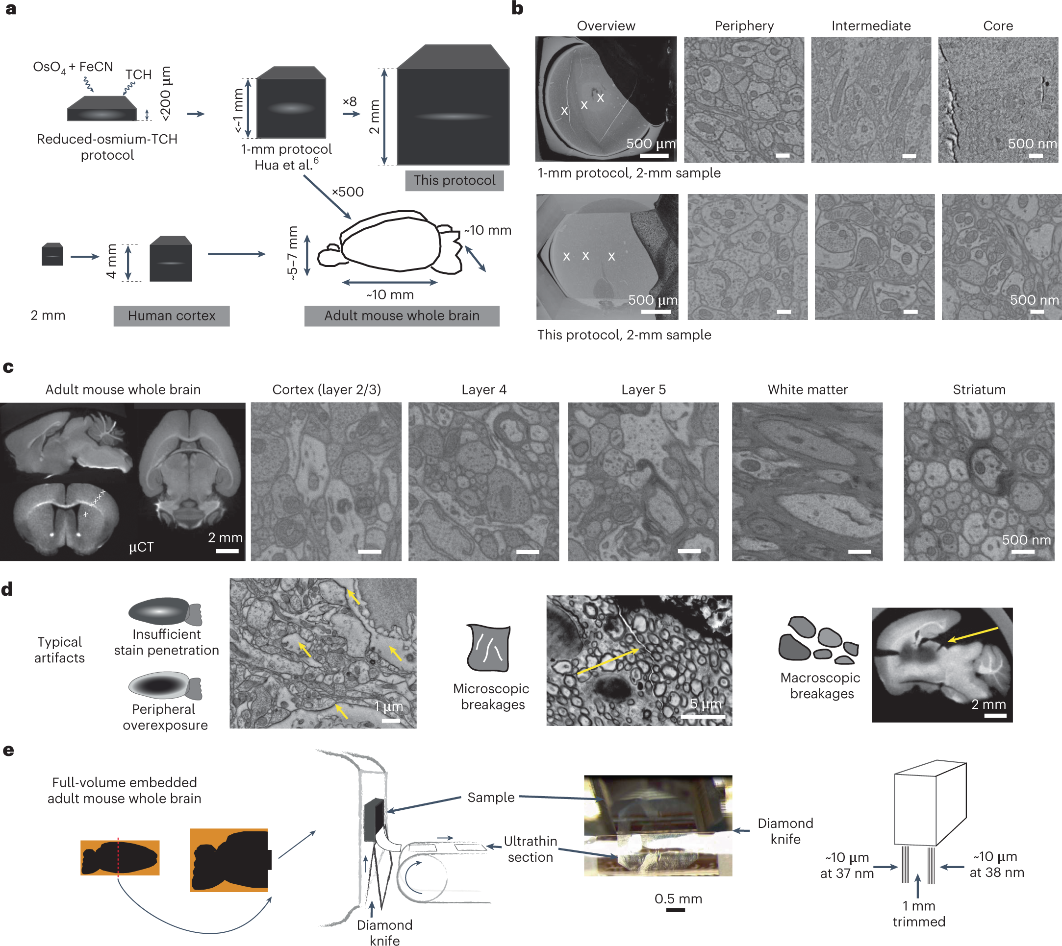 High-contrast en bloc staining of mouse whole-brain and human brain samples  for EM-based connectomics | Nature Methods