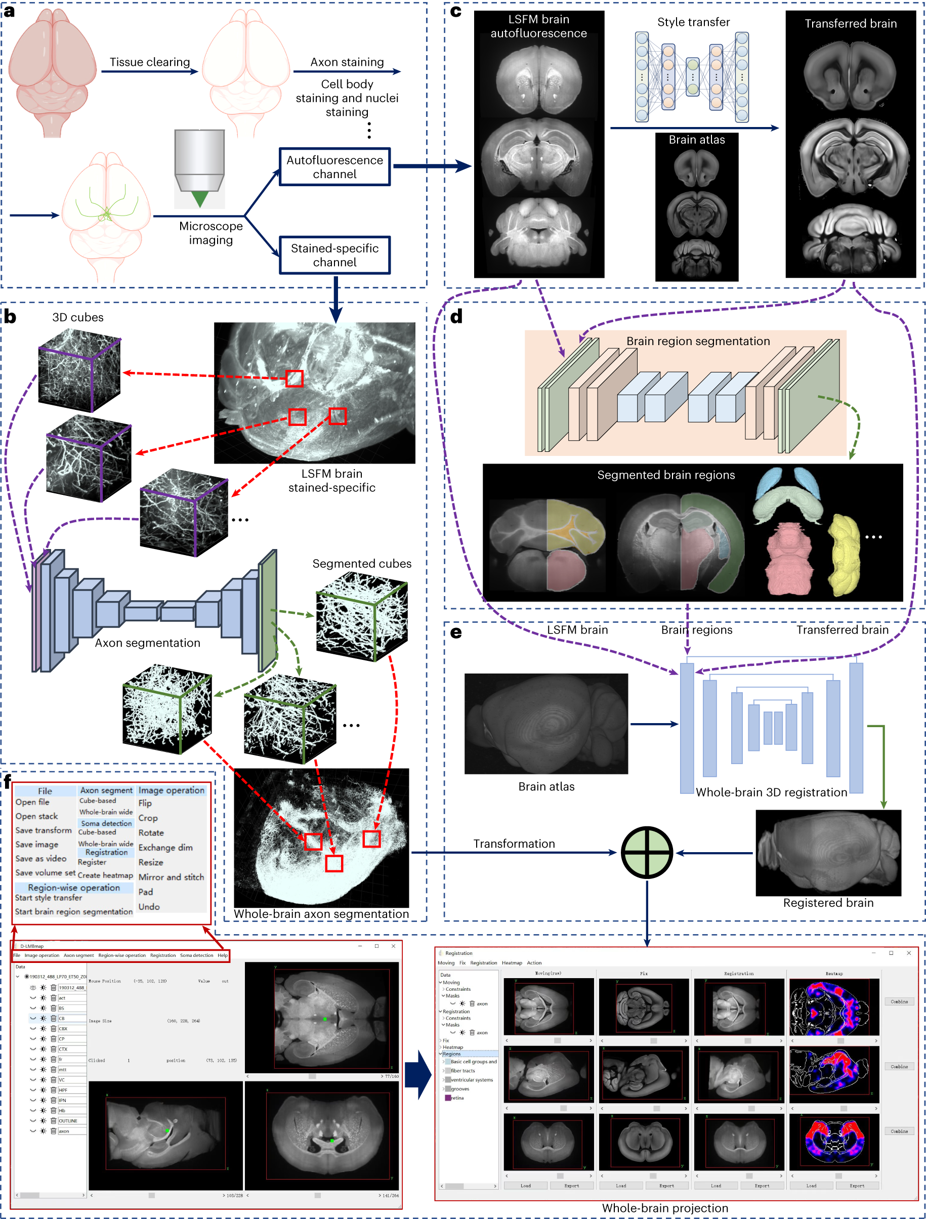 Brain Mapping, Test, Tools & Techniques - Video & Lesson Transcript