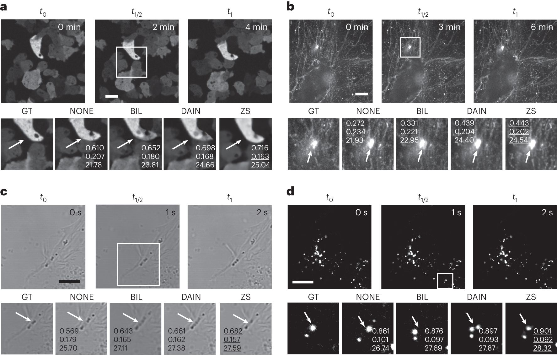 Fig. 6: CAFI allows smart interpolation for a wide range of microscopy applications.