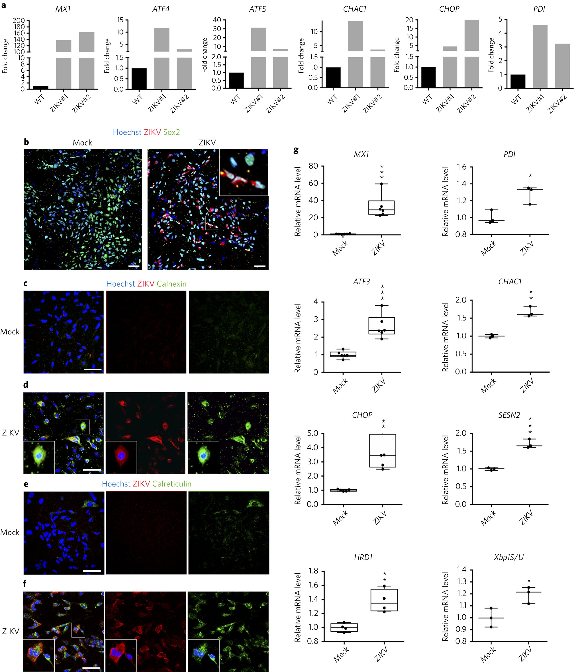 Stress Induced Unfolded Protein Response Contributes To Zika Virus Stress Induced Unfolded Protein Response Contributes To Zika Virus Ociated Microcephaly Nature Neuroscience