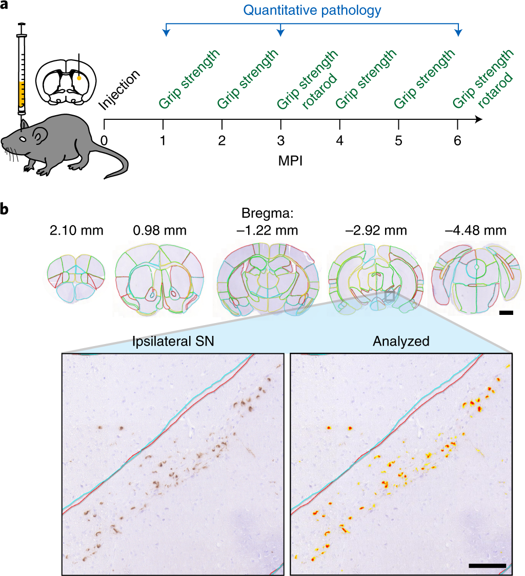 of α-synuclein pathology through the brain connectome is modulated by selective vulnerability and predicted by network | Nature