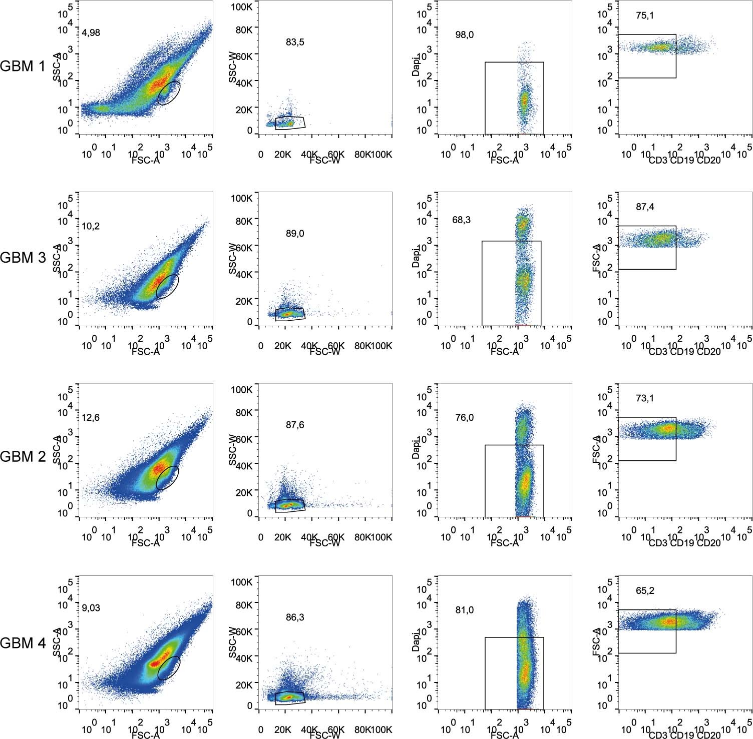 Extended Data Fig. 8: FACS plots of GBM samples. Overview of FACS plots for the GBM samples included in the study.