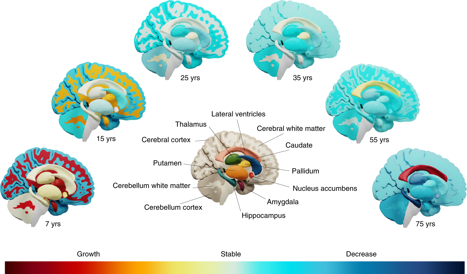 Neuroanatomy Art Print Brain Anatomy Cross Section -  Norway