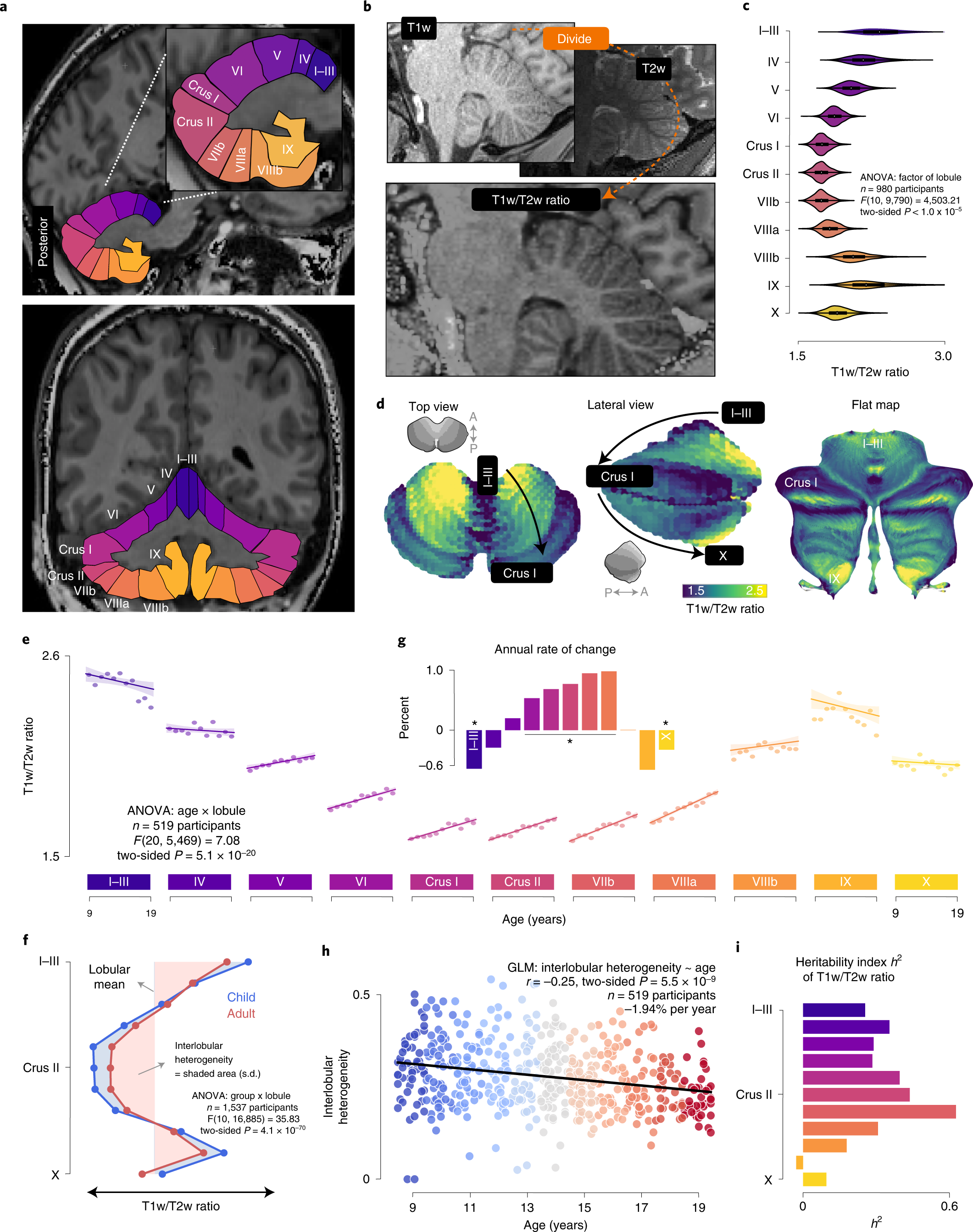 A multifaceted gradient in human cerebellum of structural and functional  development