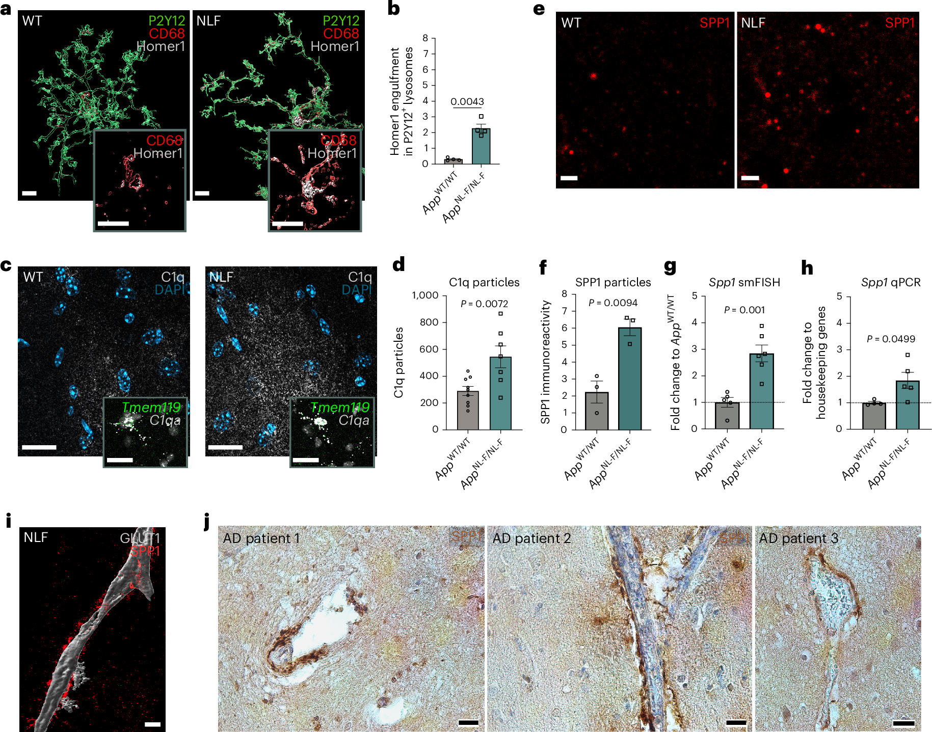Fig. 1: SPP1 upregulation at onset of microglia–synapse phagocytosis.
