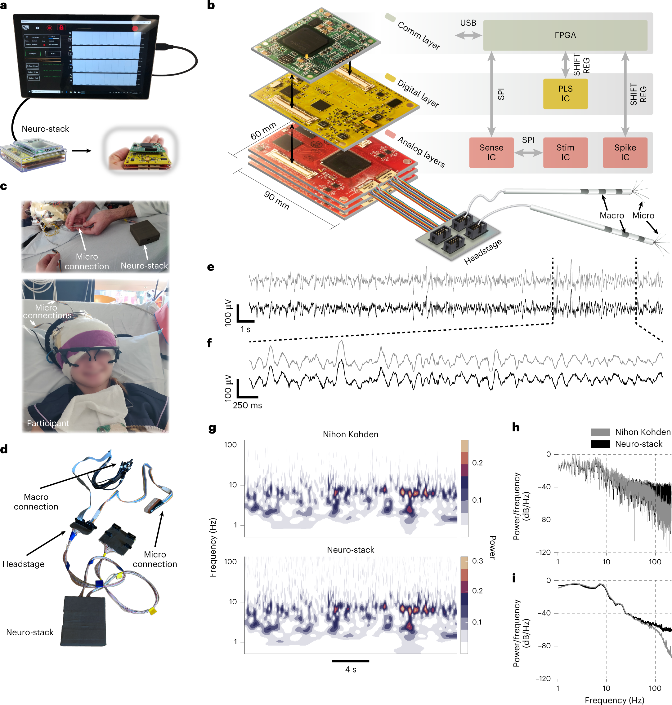 A wearable platform for closed-loop stimulation and recording of  single-neuron and local field potential activity in freely moving humans |  Nature Neuroscience