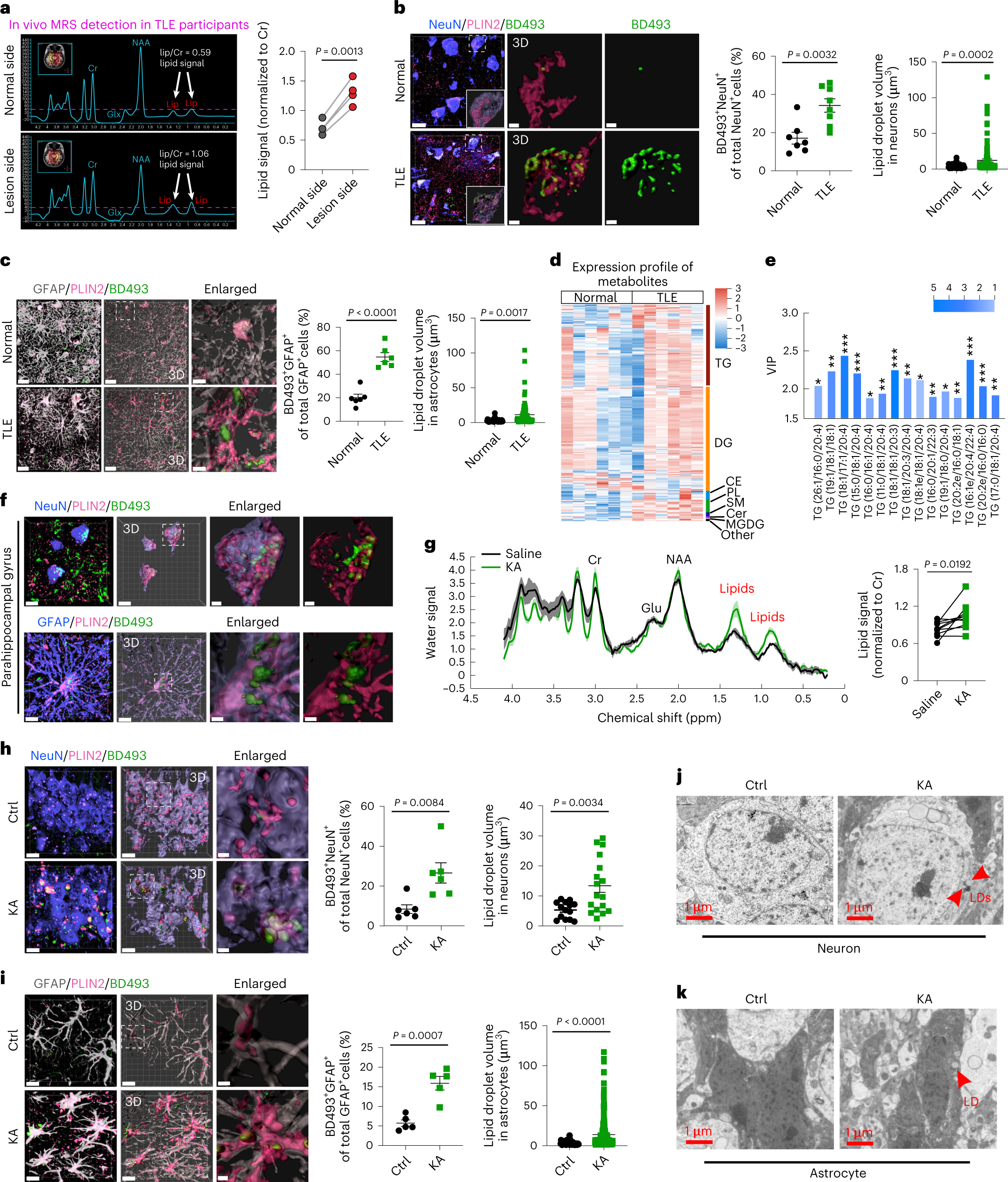 Lipid-accumulated reactive astrocytes promote disease progression in  epilepsy Nature Neuroscience