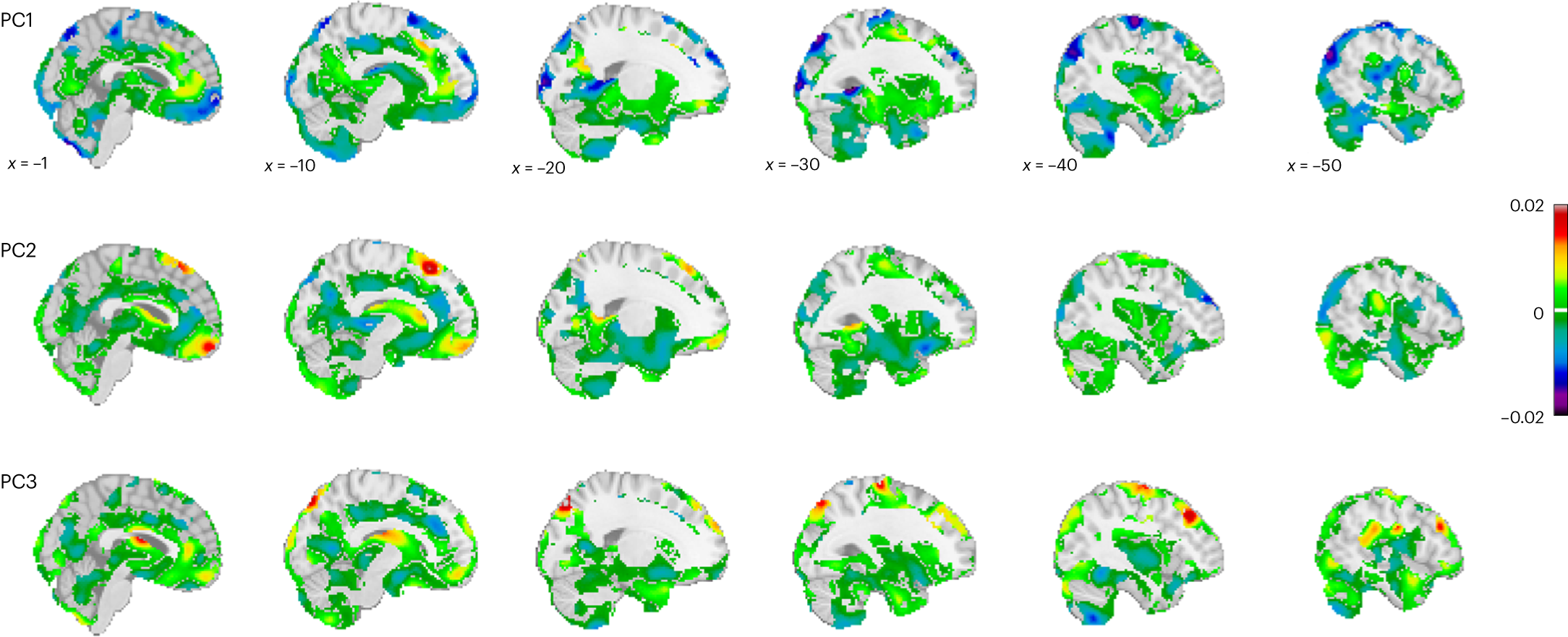 Fig. 3: Predictions of how brain morphometry (Jacobian determinants of deformation fields) changes as a function of adversity.