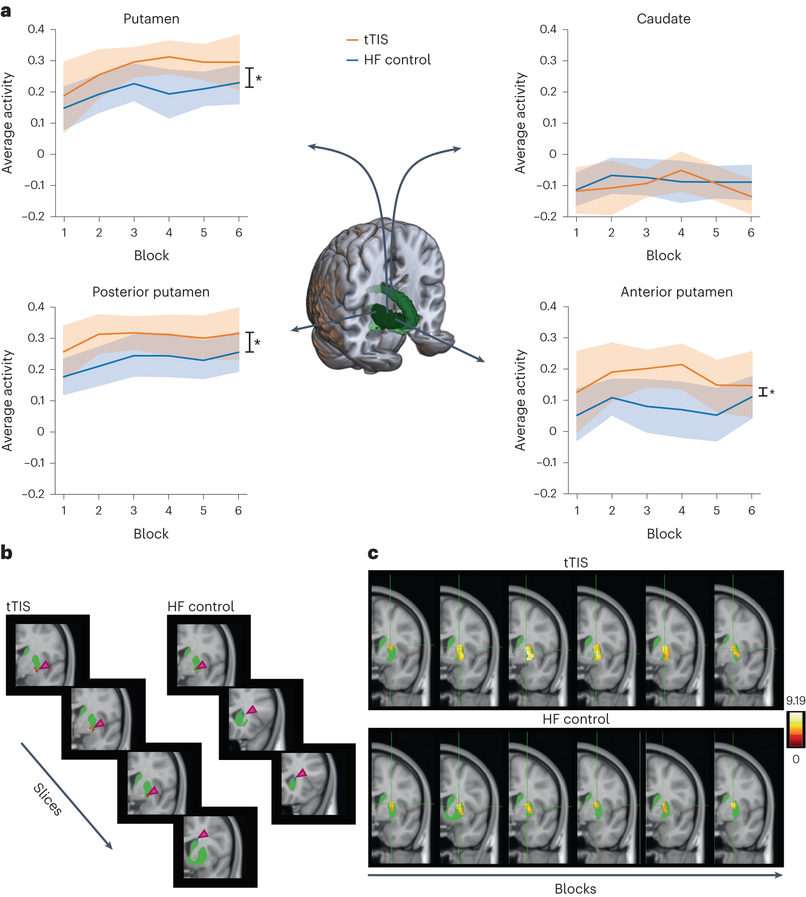 Frequency-specific neuromodulation of local and distant