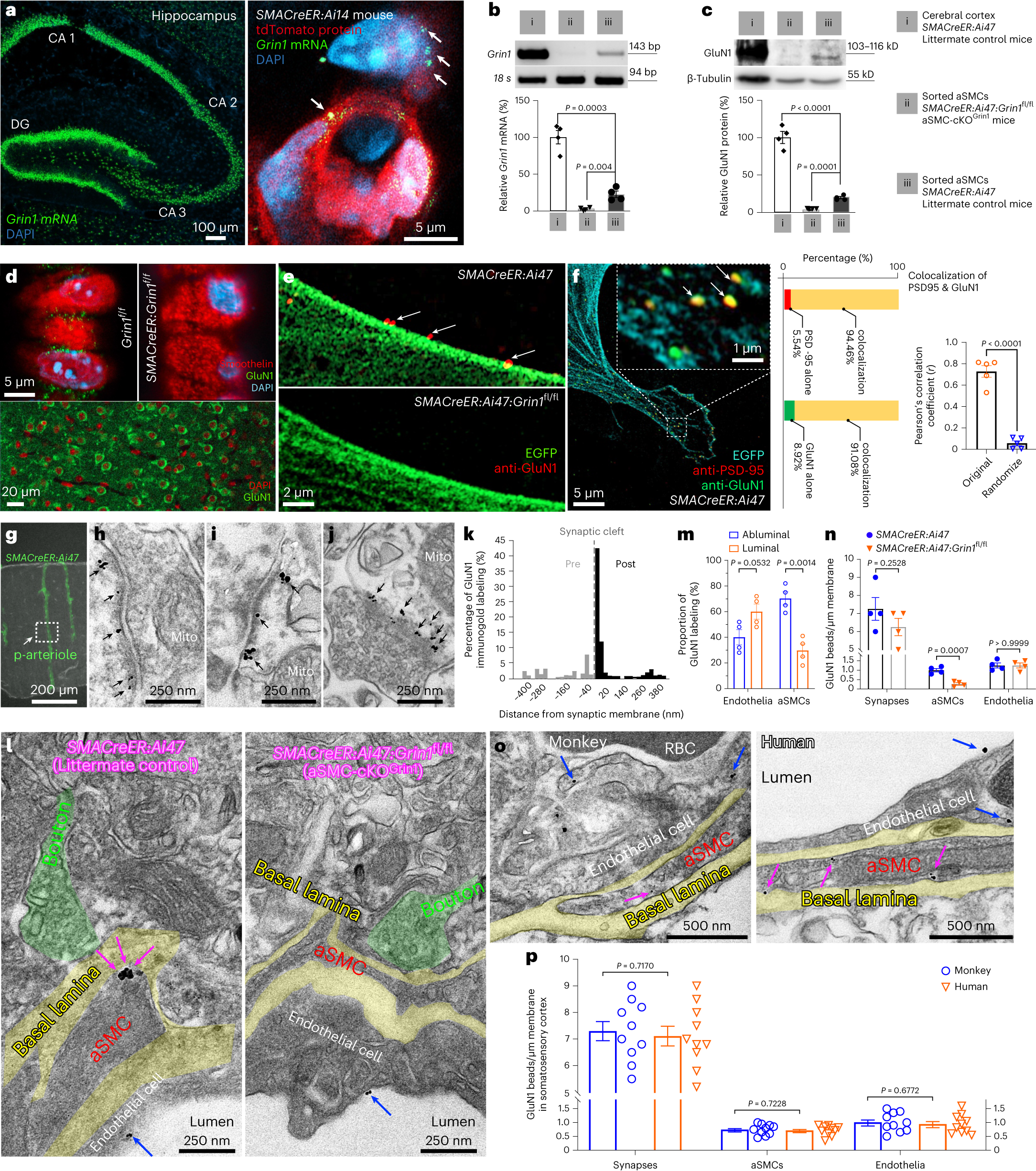 Fig. 3: Abluminal expression of GluN1 in mouse and primate cerebral aSMCs.