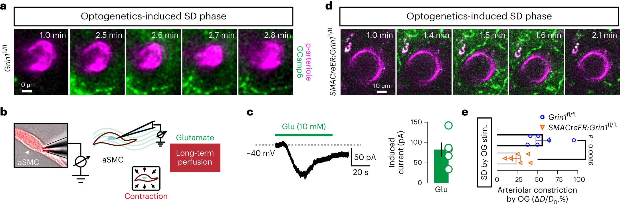 Fig. 7: Genetic disruption of GluN1 in aSMCs attenuates vasoconstriction following neuronal SD induced by 2P optogenetics.