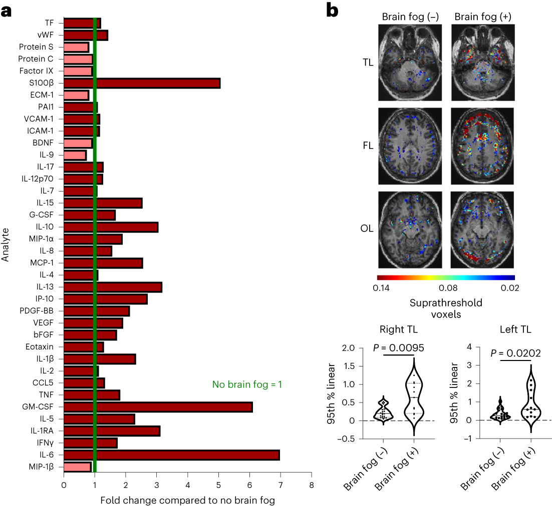 Leaky blood–brain barrier in long-COVID-associated brain fog