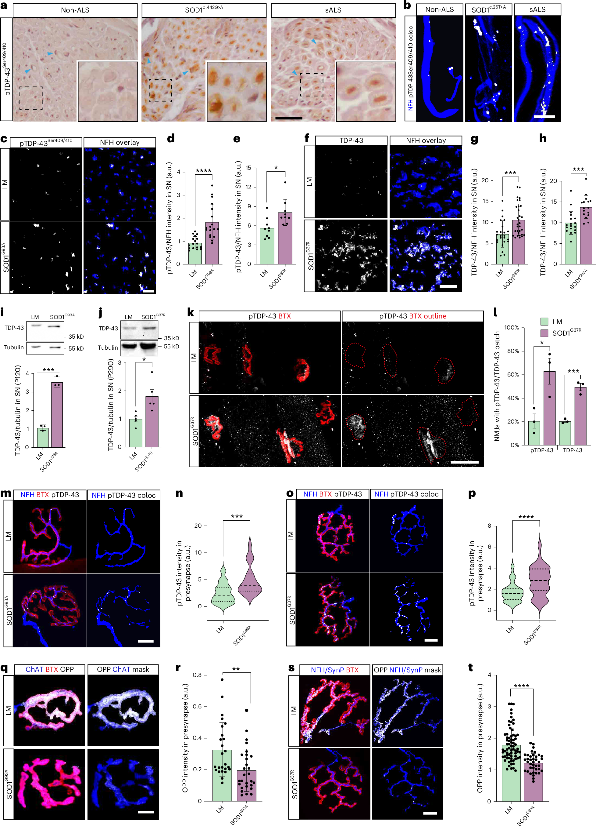 Fig. 1: TDP-43 peripheral pathology in SOD1 patients and SOD1 mouse models.