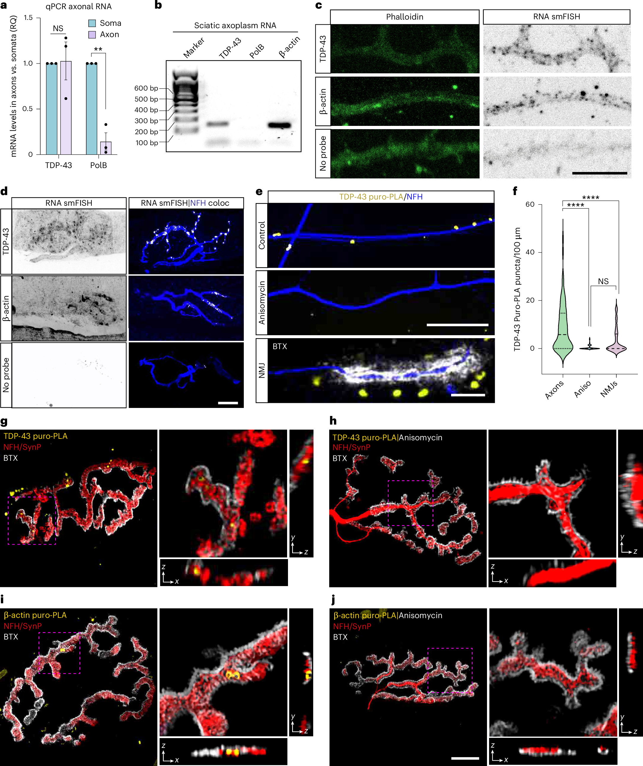 Fig. 2: TDP-43 mRNA localization and local translation in MN axons.