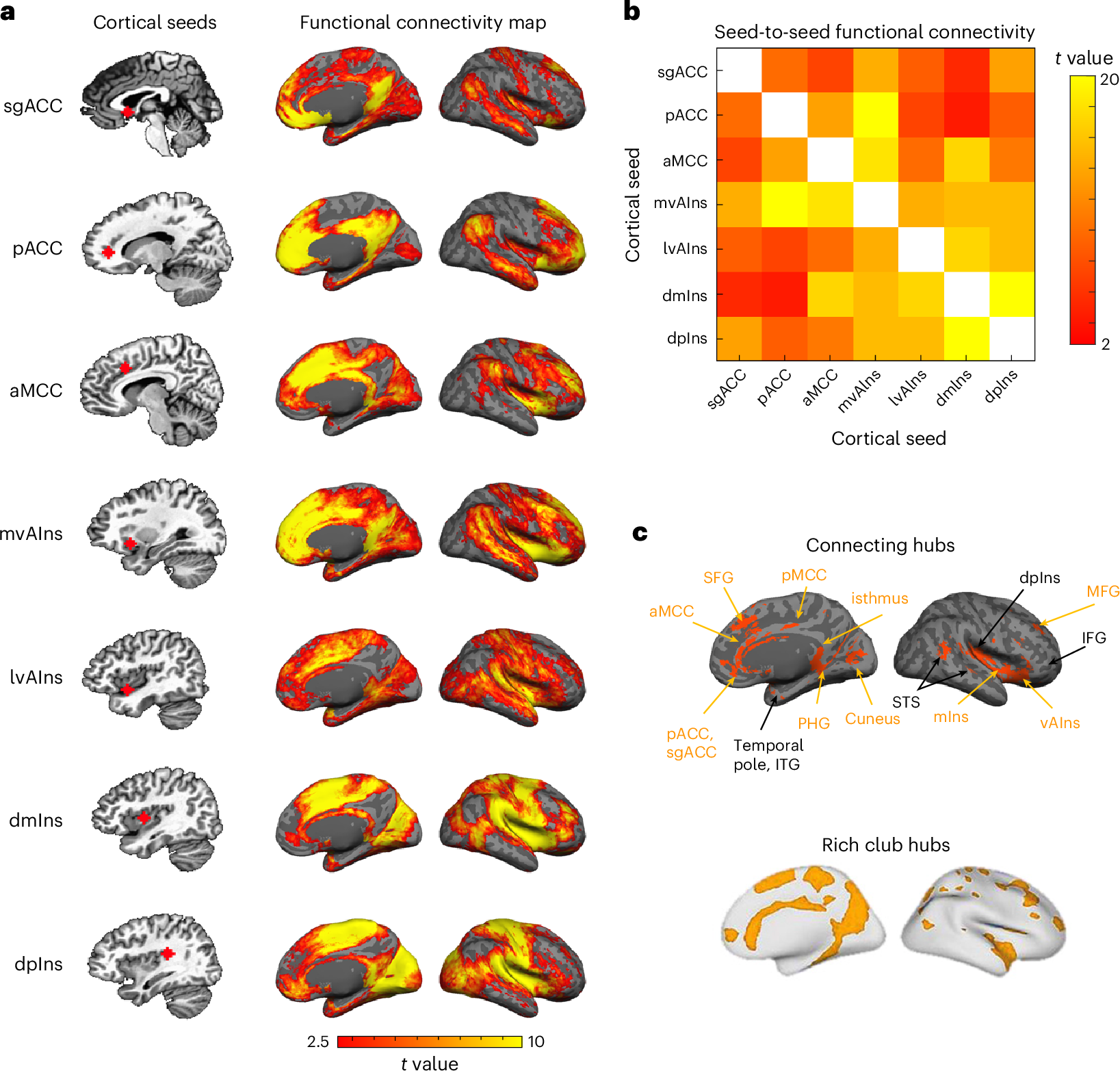 Fig. 2: Cortico-cortical functional connectivity within the allostatic–interoceptive system.