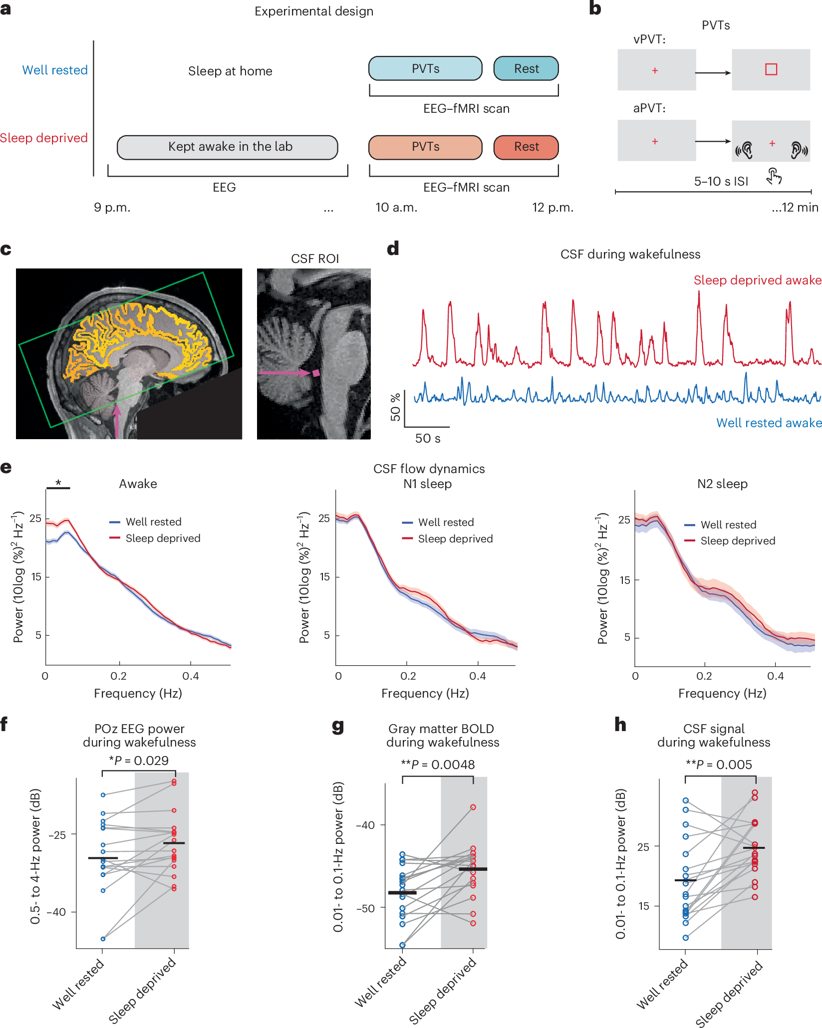 睡眠不足による注意力低下の神経メカニズム解明(Your Brain Without Sleep)