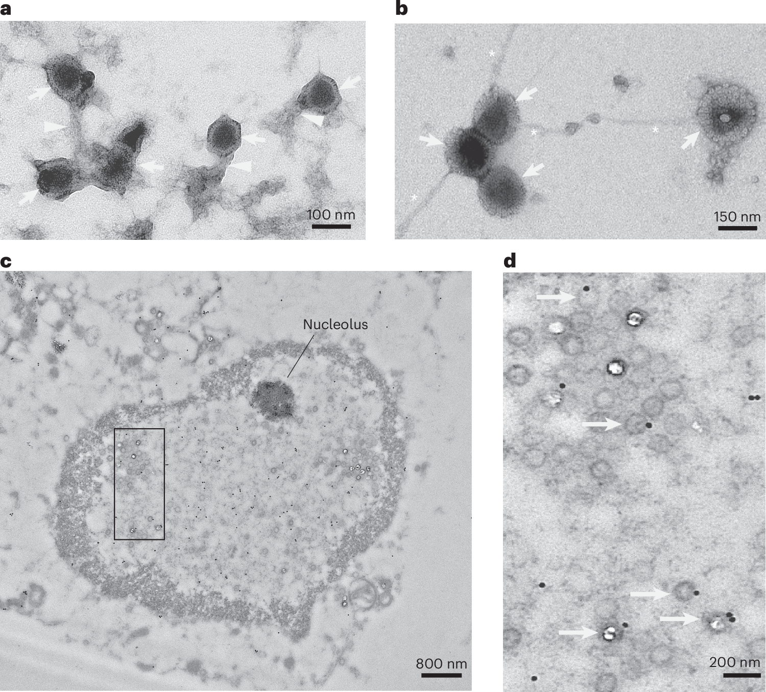 Fig. 3: HSV-1 capsids bind to intraneuronal tau and stimulate aggregation.