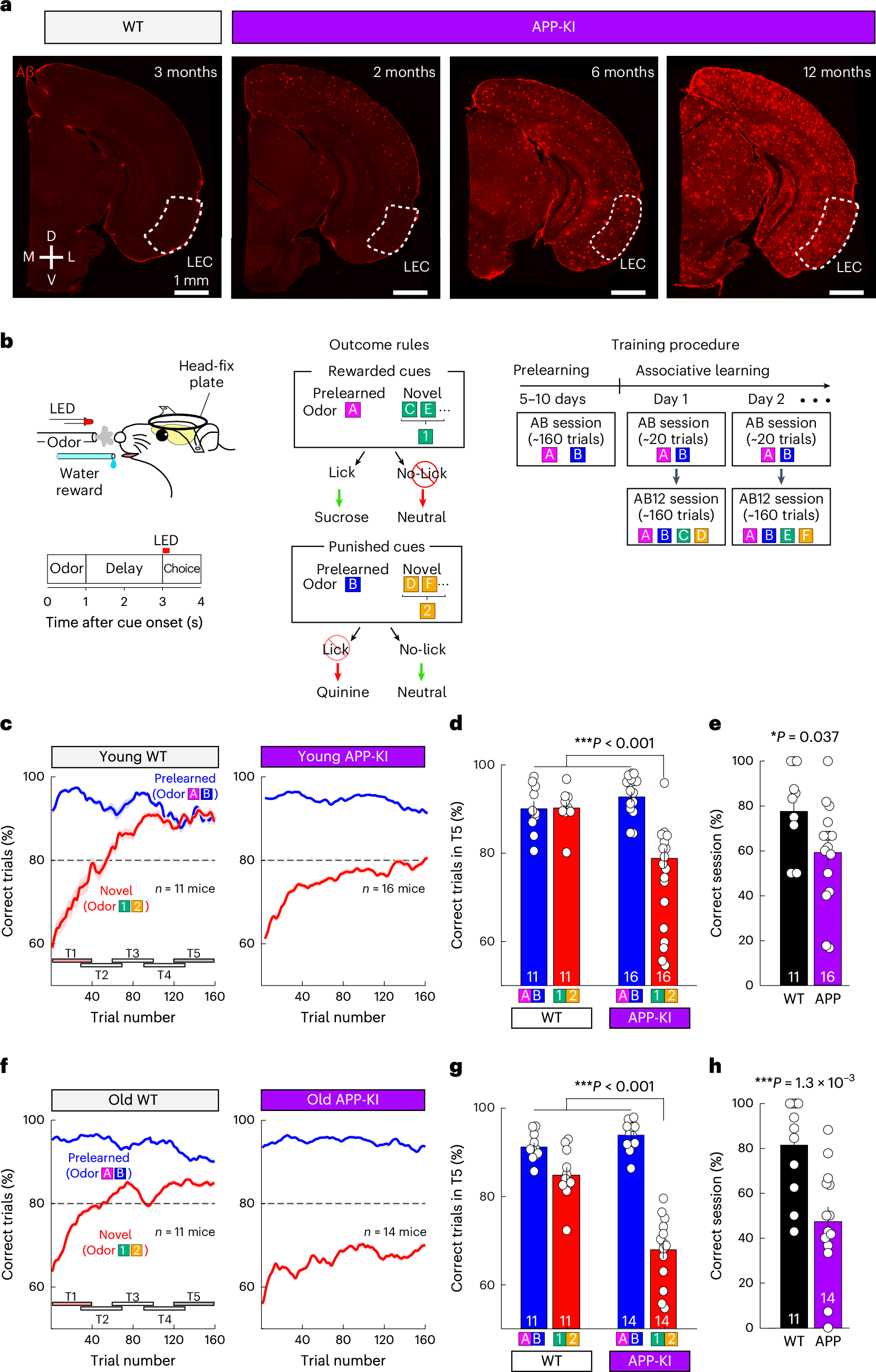 ドーパミン欠乏がアルツハイマー病の記憶障害を引き起こす（Dopamine Deficiency Found to Drive Memory Impairment in Alzheimer&rsquo;s Disease）