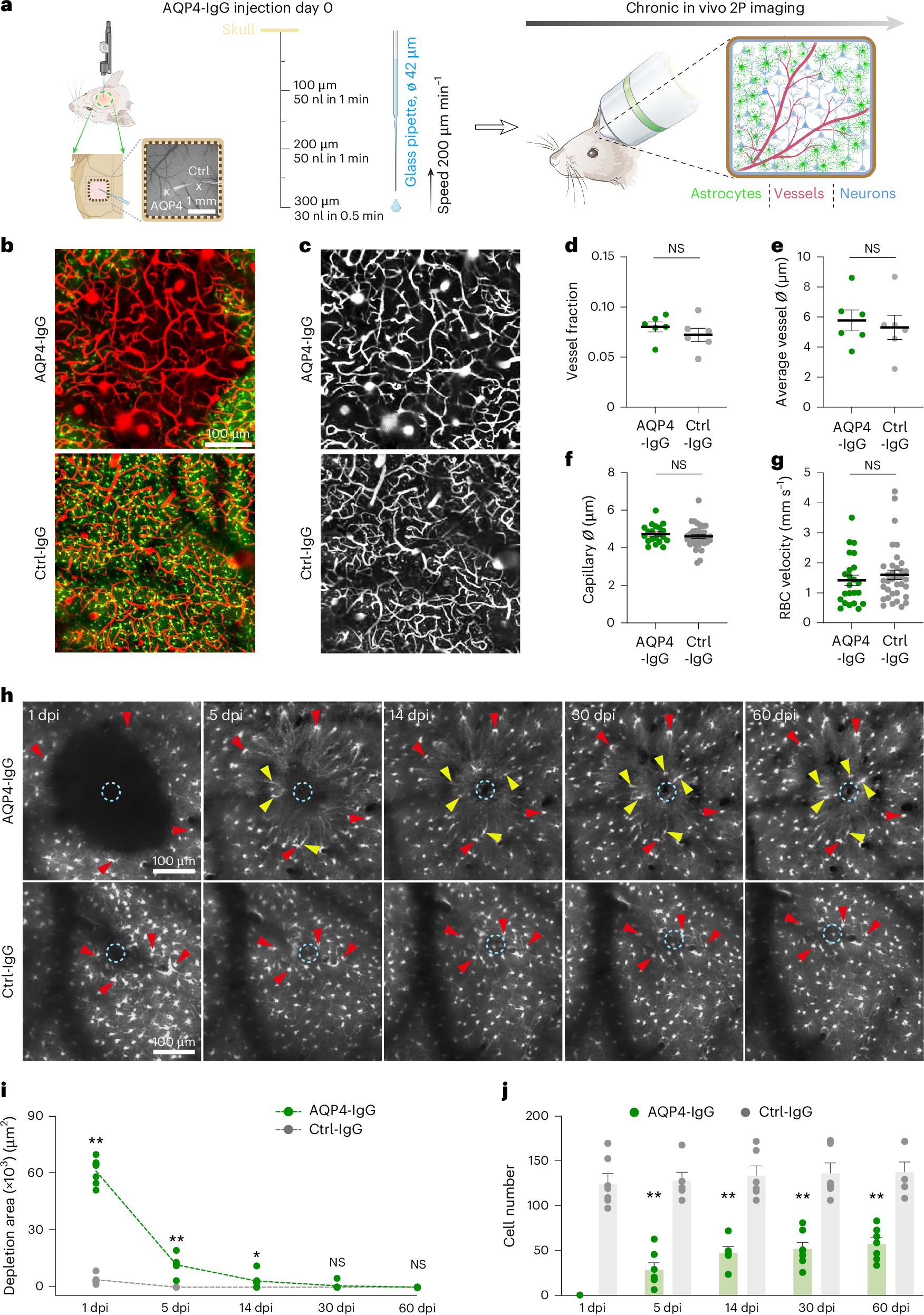 Focal astrocyte loss reveals nuclear translocation during lesion repopulation