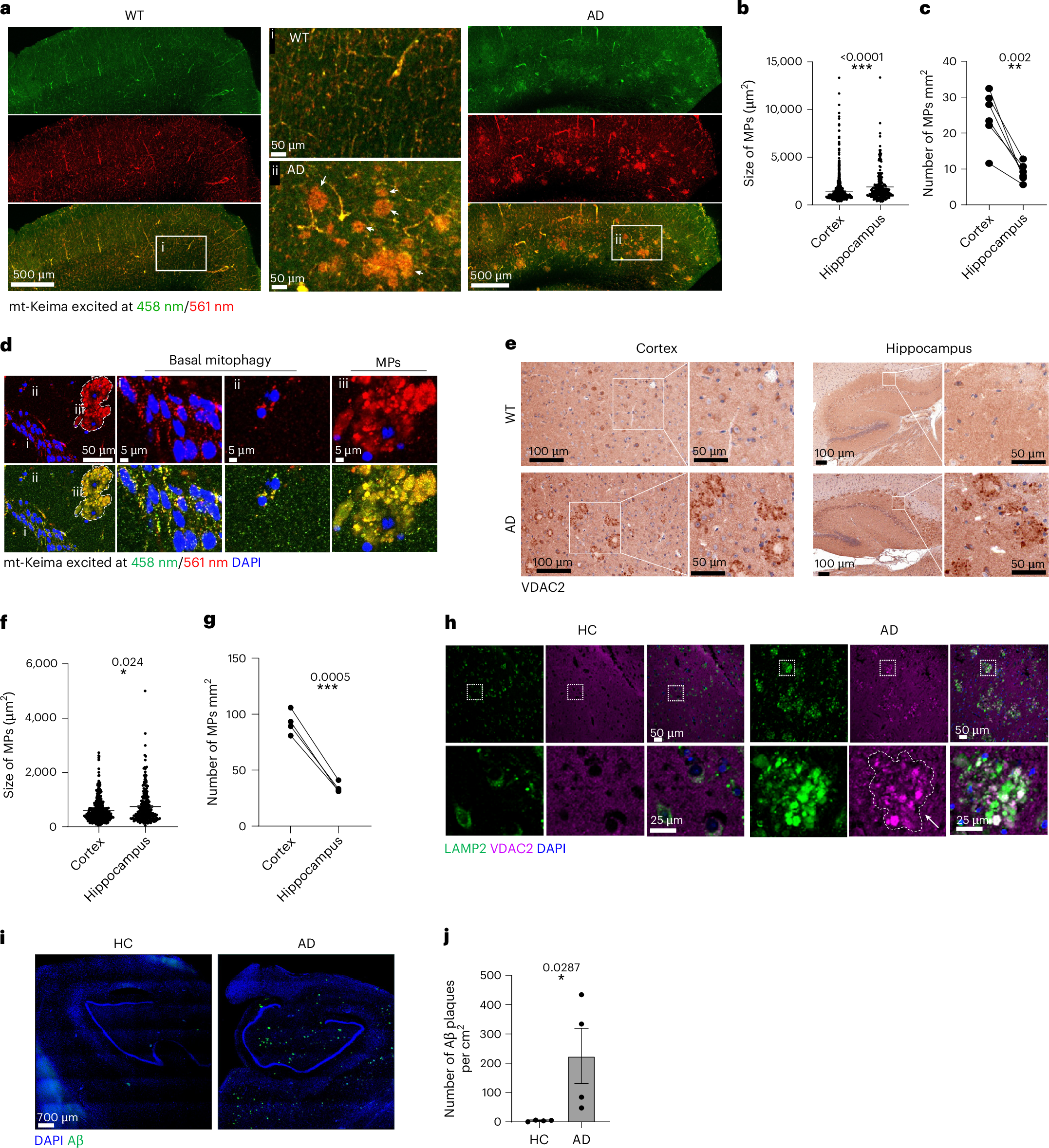 Mitochondrial accumulation and lysosomal dysfunction result in mitochondrial plaques in Alzheimer's disease