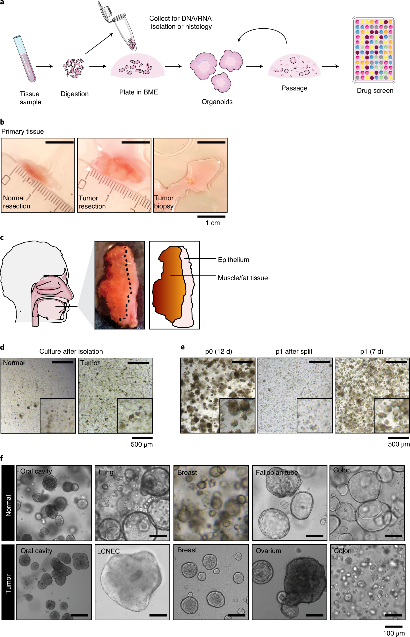 Establishment Of Patient Derived Cancer Organoids For Drug Screening Applications Nature Protocols Establishment Of Patient Derived Cancer Organoids For Drug Screening Applications Nature Protocols