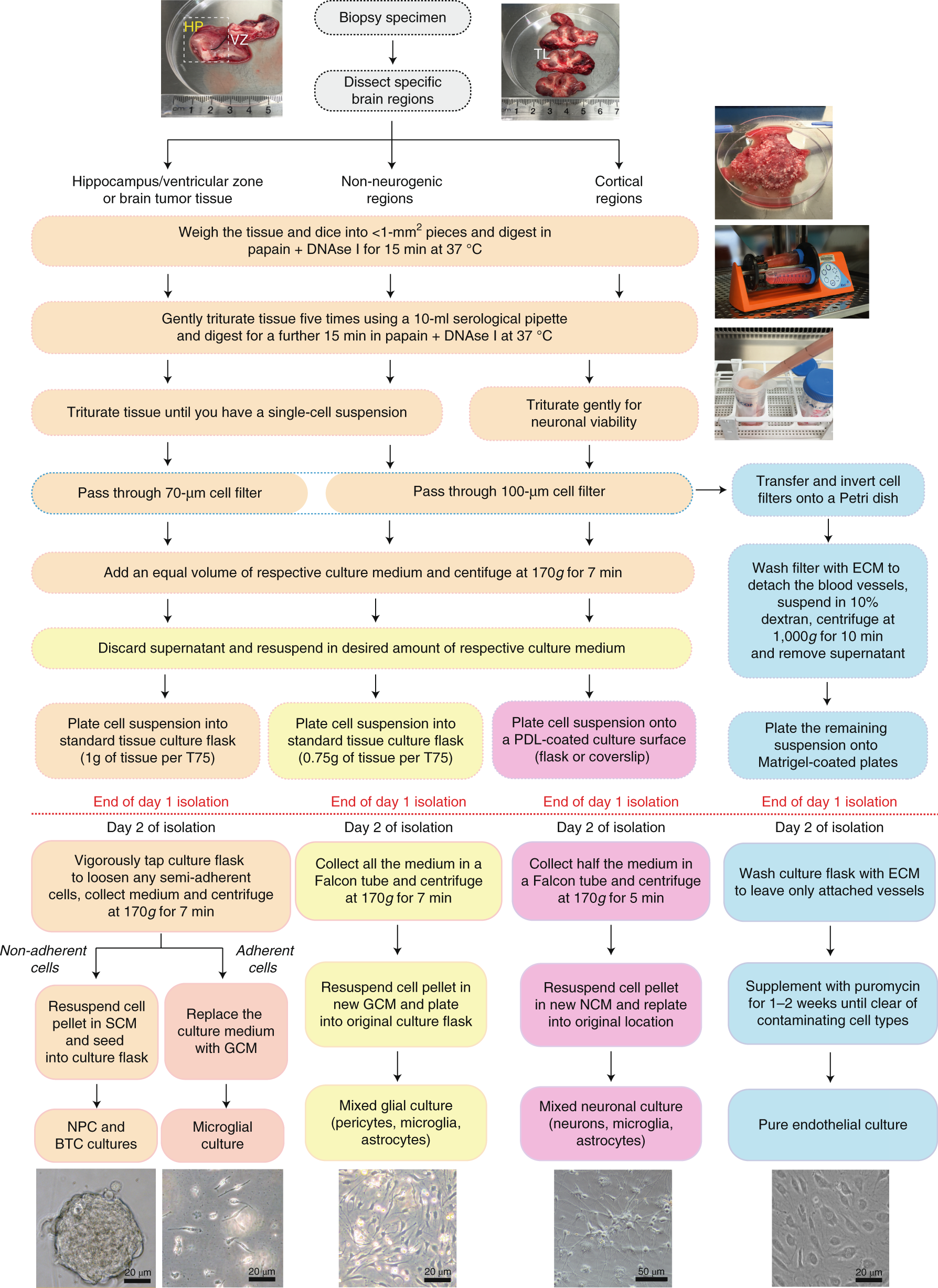 Routine culture and study of adult human brain cells from neurosurgical specimens | Nature Protocols Routine culture and study of adult human brain cells from neurosurgical specimens | Nature Protocols