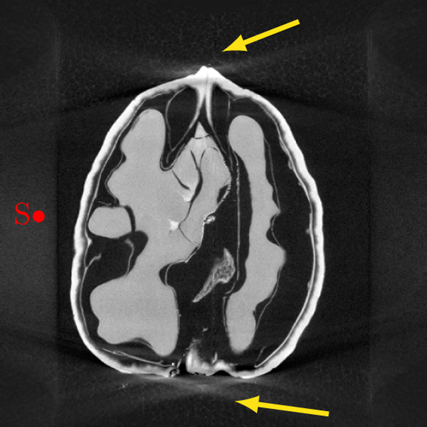 A Cone Beam X Ray Computed Tomography Data Collection