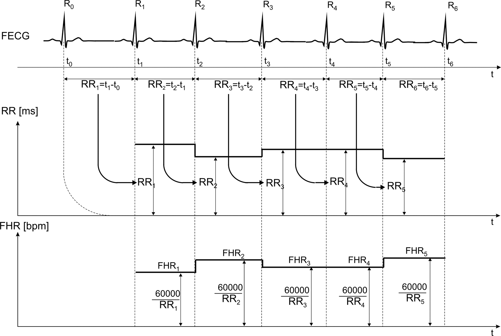 Fetal electrocardiograms, direct and abdominal with reference heartbeat  annotations | Scientific Data