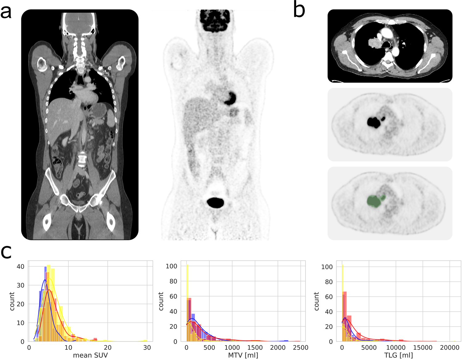 PET Scan Equipment, Department of Radiology