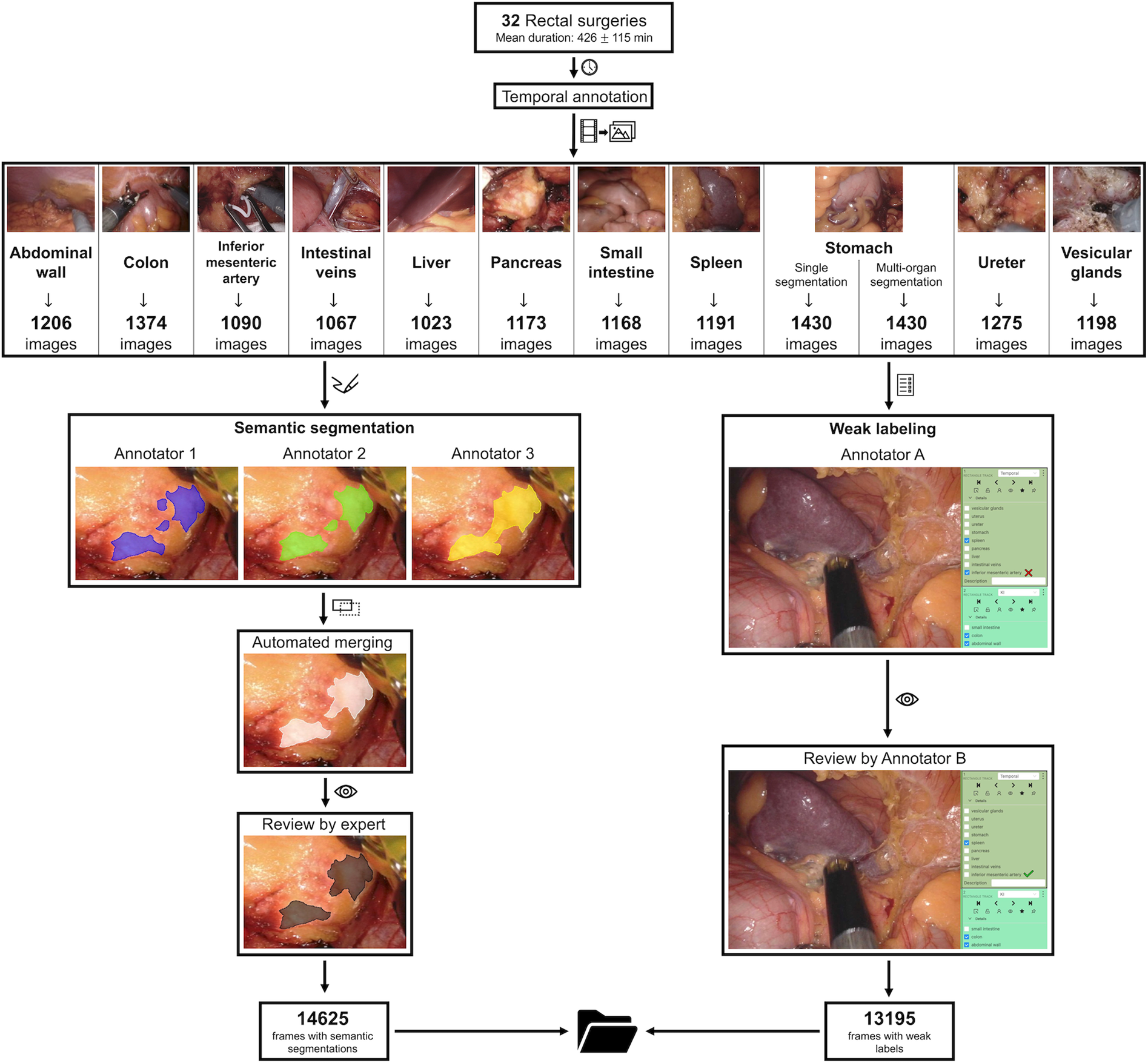 The Dresden Surgical Anatomy Dataset for Abdominal Organ Segmentation in Surgical Data Science | Scientific Data the-dresden-surgical-anatomy-dataset-for-abdominal-organ-segmentation-in-surgical-data-science-scientific-data