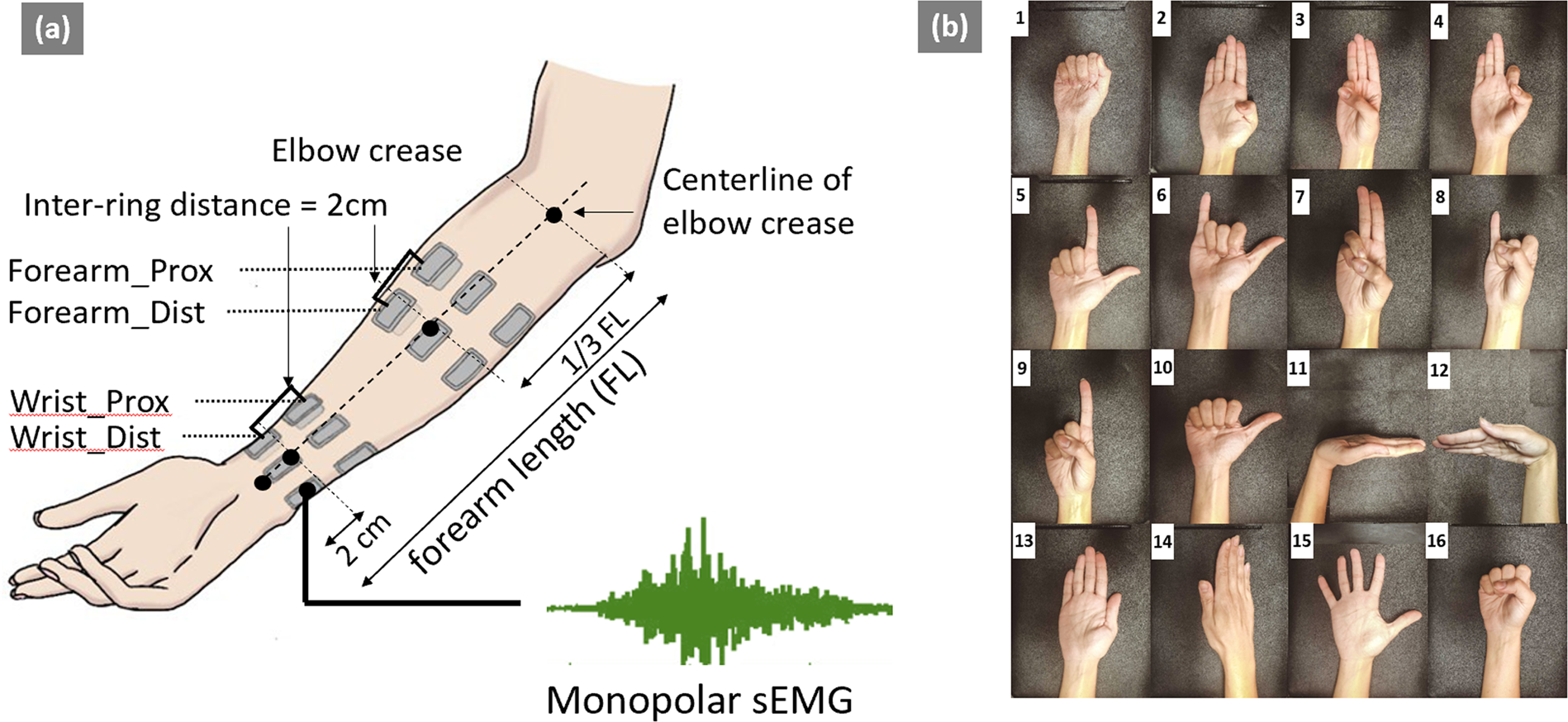 Electromyographic evaluation of upper limb muscles involved in armwrestling  sport simulation during dynamic and static conditions - ScienceDirect