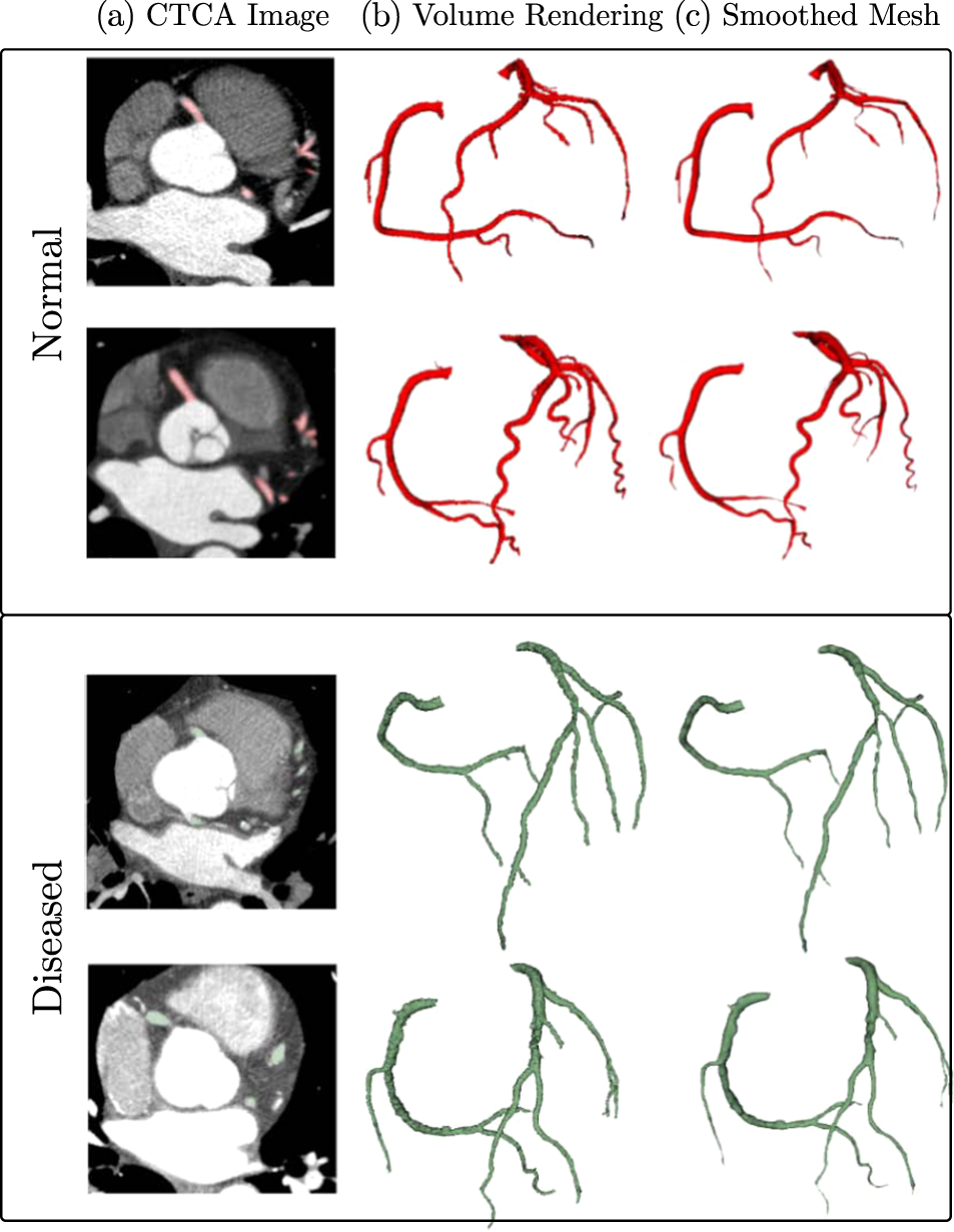 Tomography, Free Full-Text