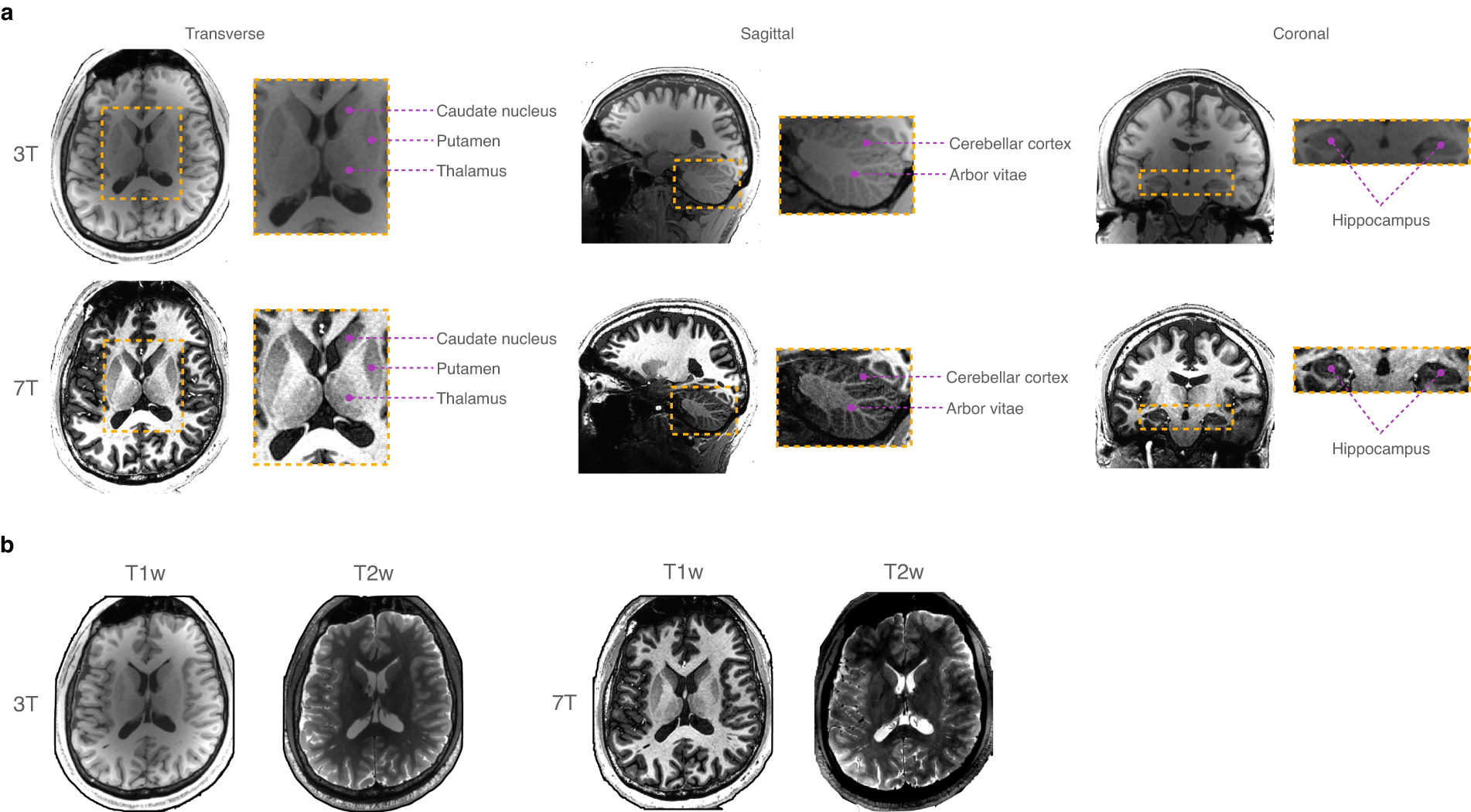 A paired dataset of T1- and T2-weighted MRI at 3 Tesla and 7 Tesla |  Scientific Data