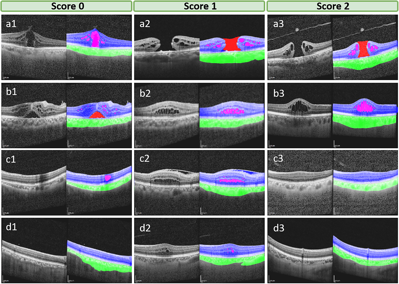 Fig. 2: Examples of different scores for the initial annotation.
