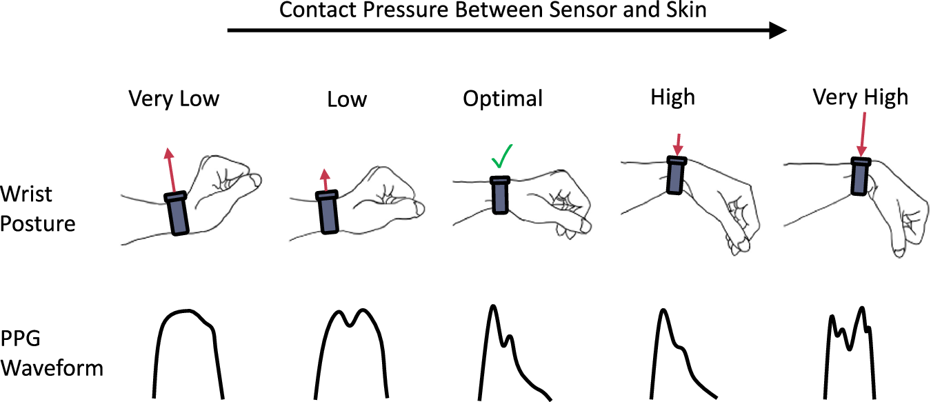 PPG sensor photoplethysmography working mechanism on smartwatch wrist