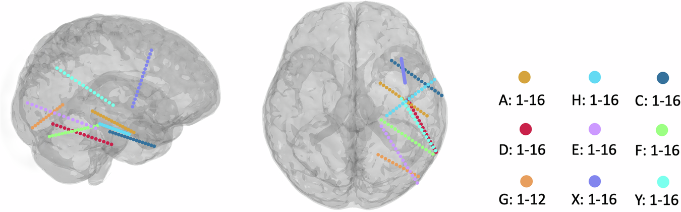 brain scan visualization showing neurological response to different vocal tonalities in sales conversations