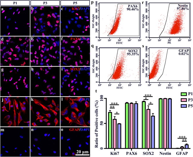 Combined transplantation of human mesenchymal stem cells and human retinal  progenitor cells into the subretinal space of RCS rats | Scientific Reports