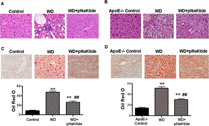 RETRACTED ARTICLE: pNaKtide Attenuates Steatohepatitis and Atherosclerosis  by Blocking Na/K-ATPase/ROS Amplification in C57Bl6 and ApoE Knockout Mice  Fed a Western Diet | Scientific Reports