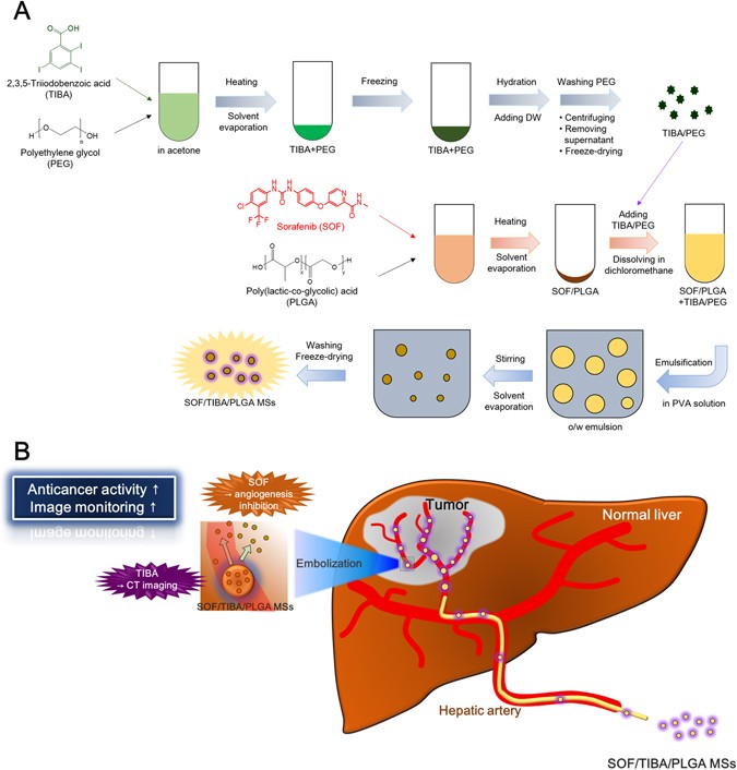 A) Preparation of DC-beads and lipiodol embolic agents currently in