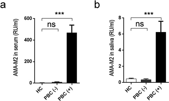 Detection of AMA-M2 in human saliva: Potentials in diagnosis and monitoring  of primary biliary cholangitis | Scientific Reports