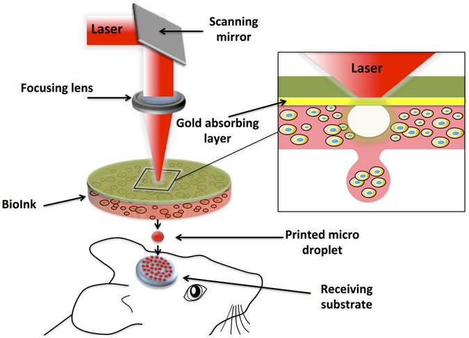 In Situ Printing Of Mesenchymal Stromal Cells By Laser - 