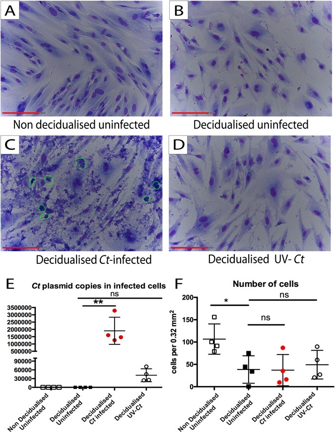 Chlamydia trachomatis infection of human endometrial stromal cells induces  defective decidualisation and chemokine release | Scientific Reports