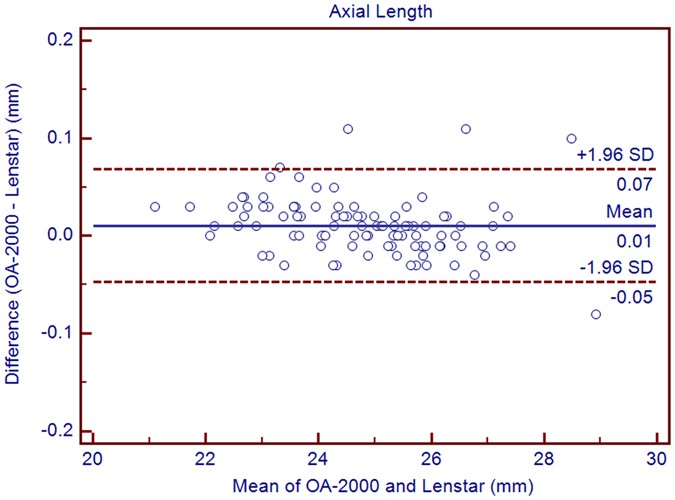 Comparison Of Ocular Biometric Measurements Between A New Swept Source Optical Coherence Tomography And A Common Optical Low Coherence Reflectometry Scientific Reports