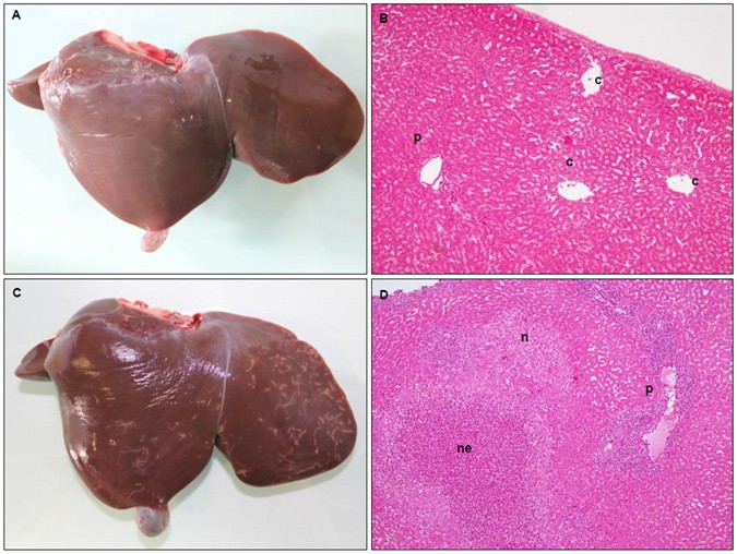 fascioliasis az