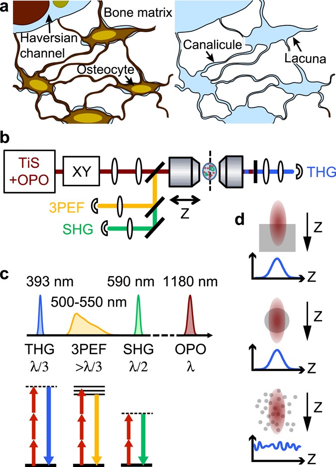 In Vivo High-Resolution Bioimaging of Bone Marrow and Fracture