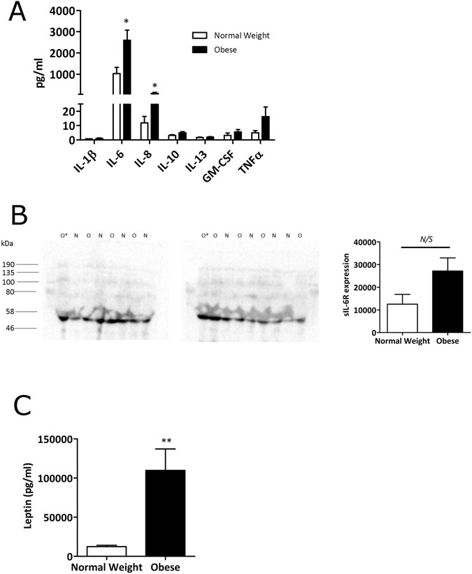 Il 6 Secretion In Osteoarthritis Patients Is Mediated By Chondrocyte Synovial Fibroblast Cross Talk And Is Enhanced By Obesity Scientific Reports