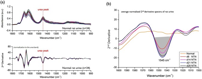Label Free Detection Of Sensitive Mid Infrared Biomarkers Of